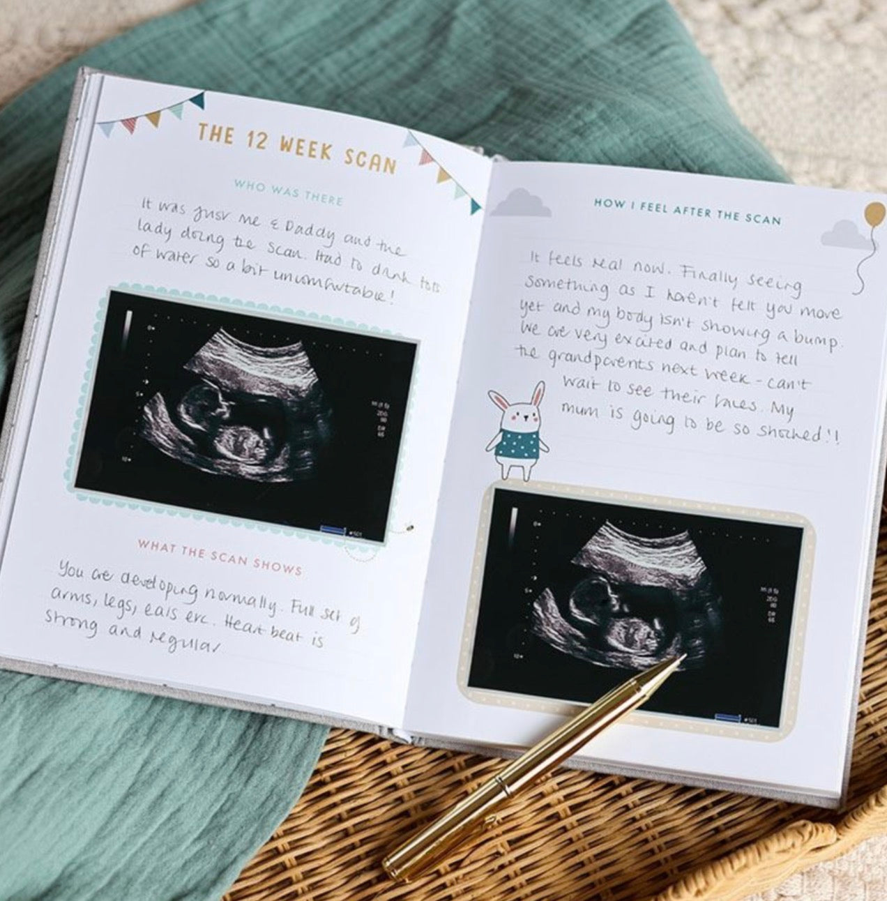 Bump to Birthday - A Pregnancy & First Year Journal